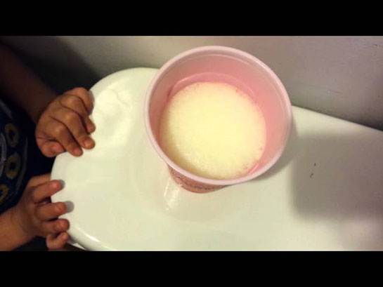 Karbonat Testi Nedir ve Nasıl Yapılır?